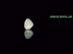 جسر التاج السيراميكي