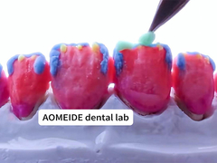 القوة الجمال الطبيعي تاج الزركونيا الصلب مناسبة تماما لأسنان واحدة أو متعددة