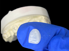 IPS e.max القشرة للشفرة في ظل A1 الجمال الطبيعي للابتسامات المثالية