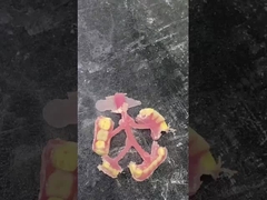 نسبيت أسنان مرنة جزئية لراحة ومتانة في استبدال الأسنان