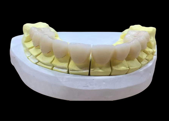 شراء تاج أسنان من البورسلين الزركونيا مع النهاية الجمالية والطبيعية من مختبر أسنان الصين online manufacture