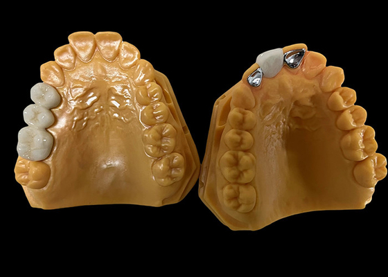 شراء البورسلين المتوسط الشفاف المذاب إلى المعدن PFM Crown ، PFM Crown Ceramic online manufacture