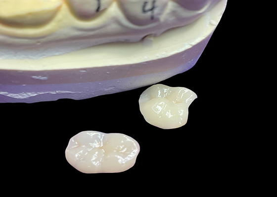 شراء IPS e.max الألواح الخزفية المزروعة والملصقة لترميم الأذنين الجمالية الطبيعية والمتانة العالية لتحقيق نتائج طويلة الأمد online manufacture