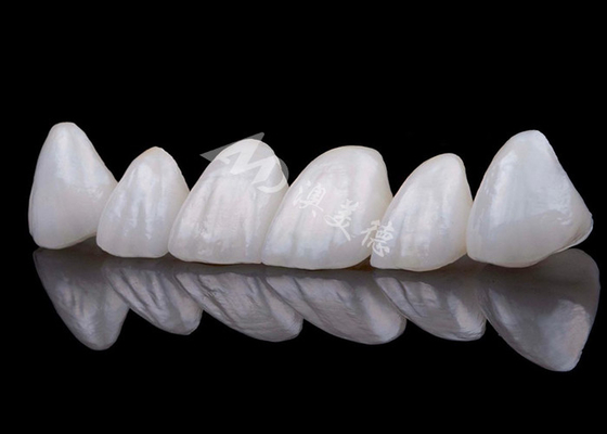 شراء الطبيعية تبدو Zirconia تاج الأسنان مقاومة للبقع كل Zirconia تاج online manufacture