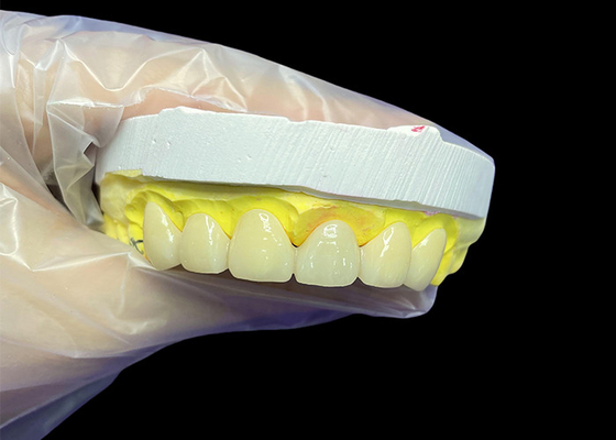 شراء التجميل فيتا الظل الكلاسيكي التاج السيراميكي والجسور مع المناسبة الدقيقة المظهر الطبيعي وخيارات قابلة للتخصيص online manufacture