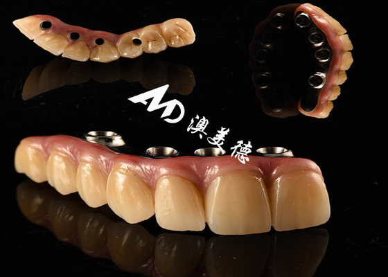 شراء زرع الأسنان الطبيعي الجسر التاج ثابت مع التيتانيوم أساس لجراحة الأسنان المفقودة online manufacture