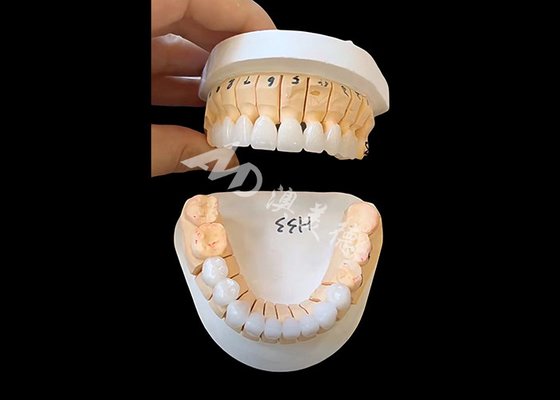 شراء تاج أسنان الزركونيا الشفاف المحسن لإصلاحات ثابتة واحدة / متعددة الوحدات online manufacture