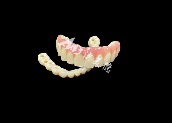 شراء الأسنان المعدنية المدعومة بالزرع الجسر الحل الأساسي للأسنان المفقودة online manufacture