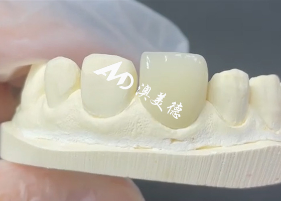 شراء القشرة EMAX القابلة للاستمرار والجمالية الحل المثالي لاستعادة البورسلين online manufacture
