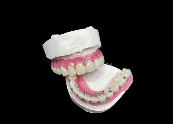 شراء زيركونيا زرع الأسنان الجسر التاج جميع على 6 لاستبدال الأسنان المفقودة online manufacture