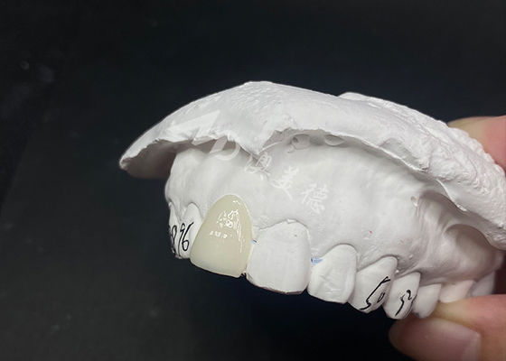 سعر جيد القشرة الأسنانية الشفافة السريعة والفعالة لابتسامة دائمة الانترنت