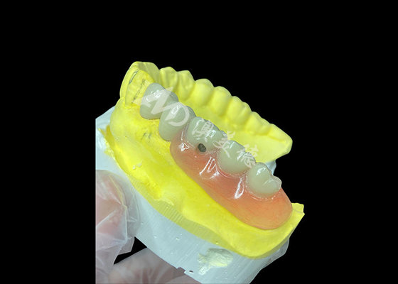 شراء مزيج من الأسنان المنزلية المنزلية و الأسنان المنزلية الشخصية الحل النهائي للراحة والجمال online manufacture