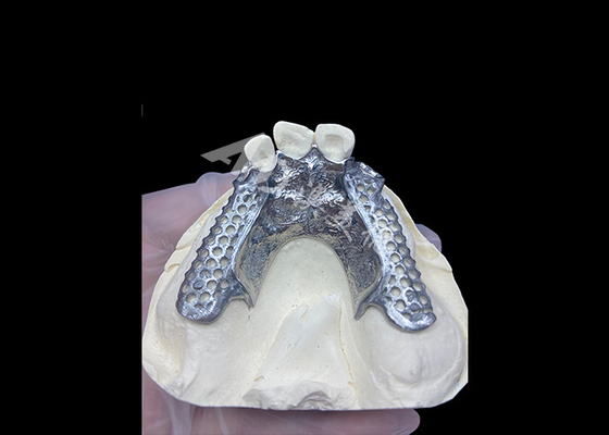 شراء من السهل تثبيت طقم الأسنان الجزئي المصبوب حسب الطلب إطار ثابت وطبيعي للنتائج السريعة online manufacture