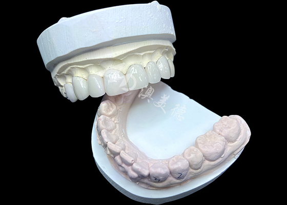 شراء IPS e.max الشاشات في ظل BL2 تحقق جماليات طبيعية مذهلة مع 8 وحدات مصنوعة بشكل مثالي online manufacture