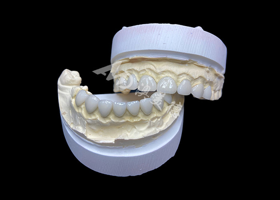 شراء تخصيص الزجاج الخفيف للغاية القشرة السيراميكية الشفافية العالية لابتسامة طبيعية online manufacture