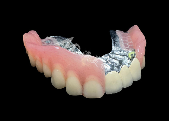شراء تحسين ابتساماتك البديهية جسر التاج PFM و أسنان مستعار قابلة للإزالة online manufacture