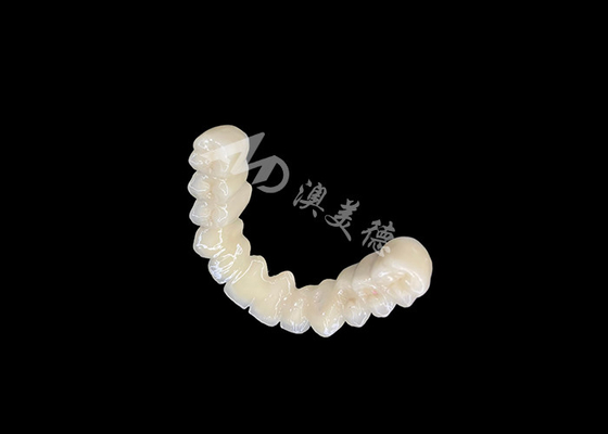 شراء ربط طويل الأمد PFM جسر تاج الأسنان مع التوافق البيولوجي الممتاز ربط آمن online manufacture