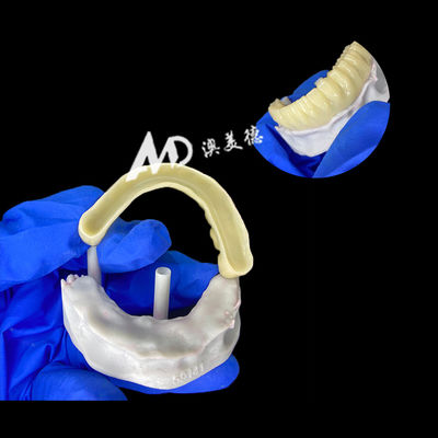 شراء جسر زرع مؤقت PMMA مع جوفة في الداخل للاستقرار والشفاء الطبيعي ، صناعة CAD / CAM عالية الدقة ، مادة PMMA المتوافقة بيولوجيا online manufacture