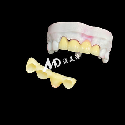شراء Premium Ceramic Crowns and Bridges for High-Strength, Natural Aesthetics and Long-Lasting Clinical Performance online manufacture