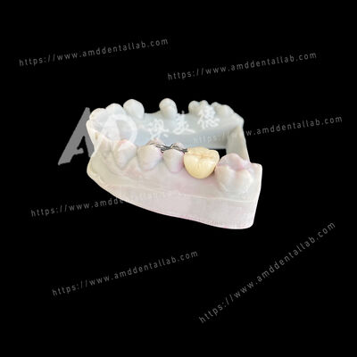 شراء PFM جسر ماريلاند واحد بونتيك جناحين حل محافظ وجمالي online manufacture