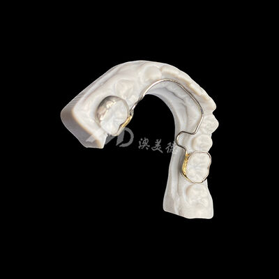 شراء قوس لغوي مخصص مع عصابات أجهزة تقويم الأسنان للحفاظ على المساحة ومواءمة الأسنان online manufacture