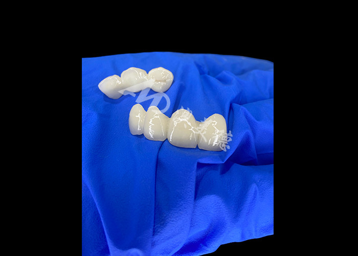 Wieland Zenostar الجسر السيراميكي للتاج دقة عالية لاستعادة دائمة وطبيعية