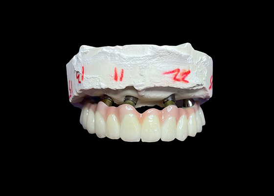 سعر جيد زراعة الأسنان مع دعم زراعة الأسنان الثابتة الكاملة للحصول على حل دائم ومستقر وطبيعي لمشكلة فقدان الأسنان الانترنت