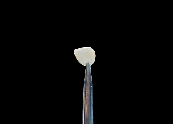 سعر جيد دقة 0.2-0.5 ملم EMAX التجميل الأسنان القماش الطبيعي المظهر الكيميائي الارتباط الانترنت