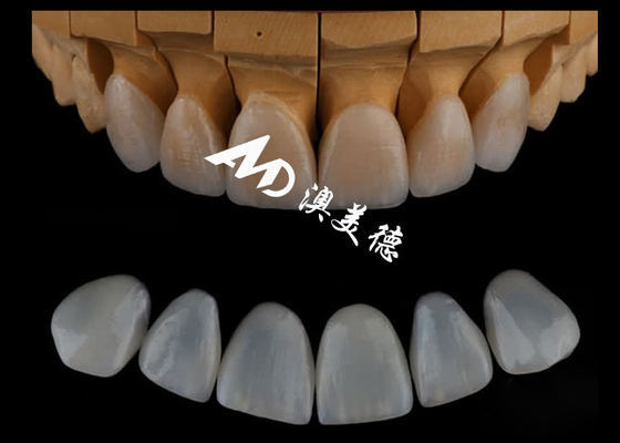 سعر جيد ملفات Emax المخصصة بدقة عالية / ملفات الأسنان البورسلينية لطب الأسنان التجميلية الانترنت