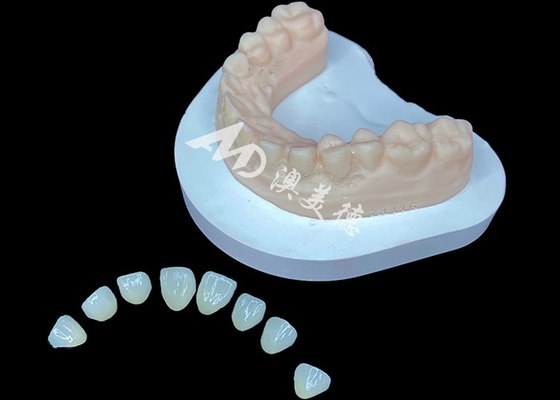 سعر جيد IPS e.max Veneer الحل الجمالي المتميز لتحويلات ابتسامة مذهلة الانترنت