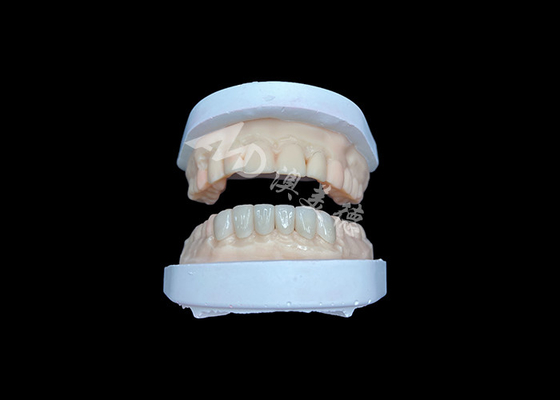 سعر جيد IPS Emax Veneers إعادة النظر الطبيعية للابتسامات الجمالية الانترنت