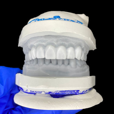 سعر جيد Diagnostic Wax-Up for Porcelain Veneers الانترنت