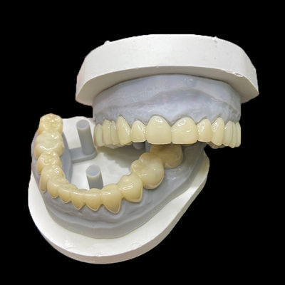 سعر جيد PMMA Temporary Restorations CAD/CAM PMMA Crowns and Bridges for Provisional Dental Cases الانترنت