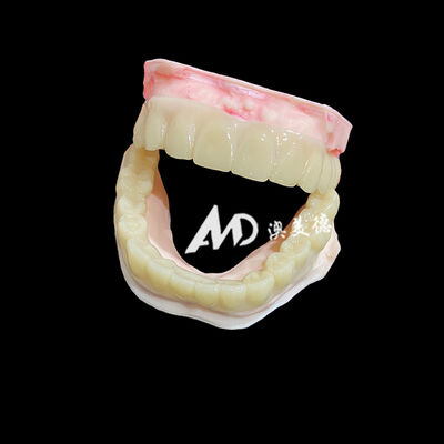 سعر جيد Lightweight PMMA Temporary Bridges with Hollow Design for Implant Restorations الانترنت