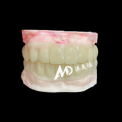 سعر جيد PMMA Hollow Temporary Bridges for Implant Provisional Cases الانترنت