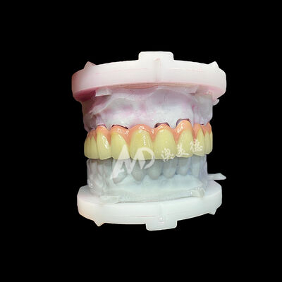 سعر جيد التاج والجسر السيراميكي النقي من التيتانيوم الانترنت