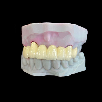 سعر جيد تاج خزفي منصهر على معدن (PFM) مع إطار Co-Cr الانترنت